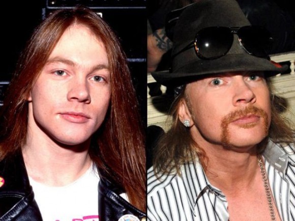 W. Axl Rose